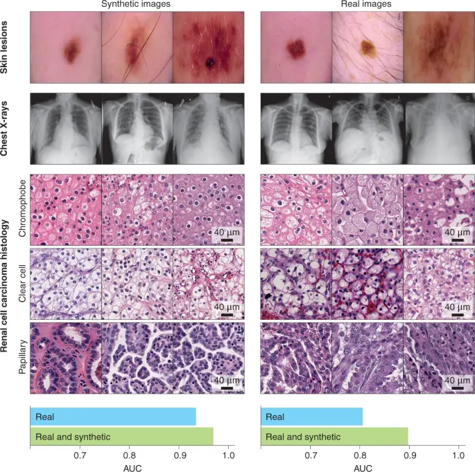 Synthetic medical images: The quality is very close to real medical images and can improve model performance when used together.